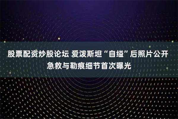股票配资炒股论坛 爱泼斯坦“自缢”后照片公开 急救与勒痕细节首次曝光